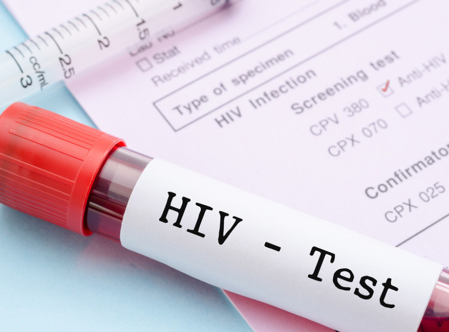 Studija: Za prevenciju HIV-a potrebne dve injekcije godišnje