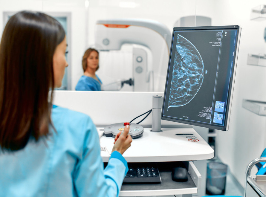 Dom zdravlja Voždovac organizuje mamografske preglede do kraja oktobra