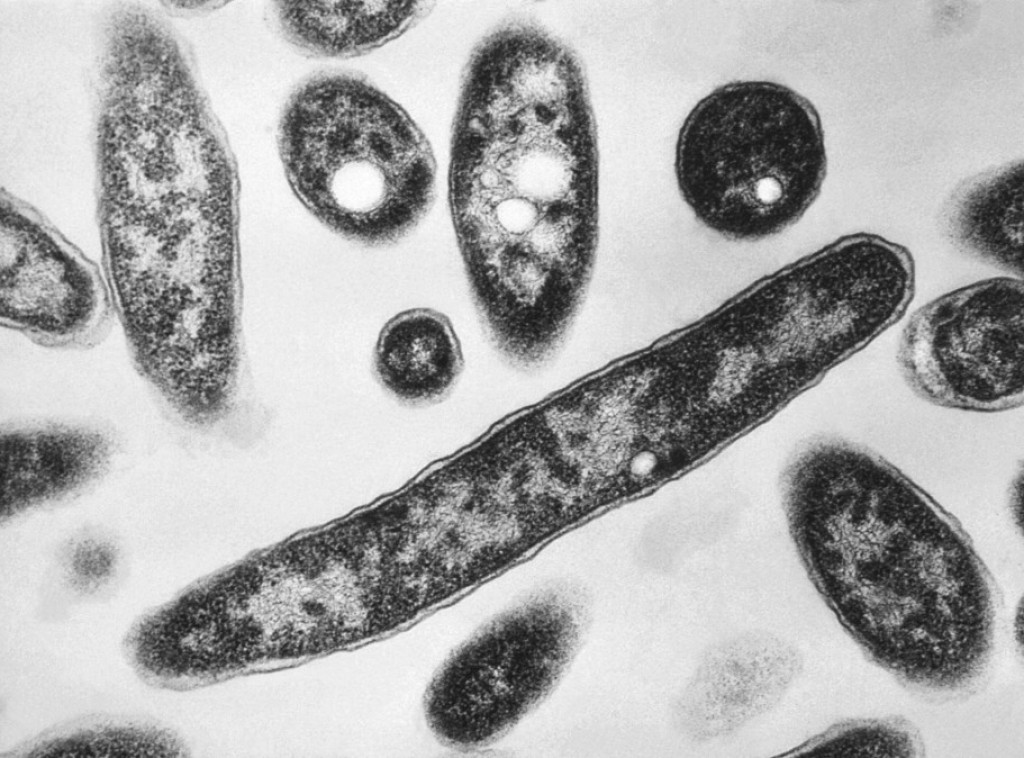 U poljskom čvorištu NATO-a buknula epidemija legionarske bolesti