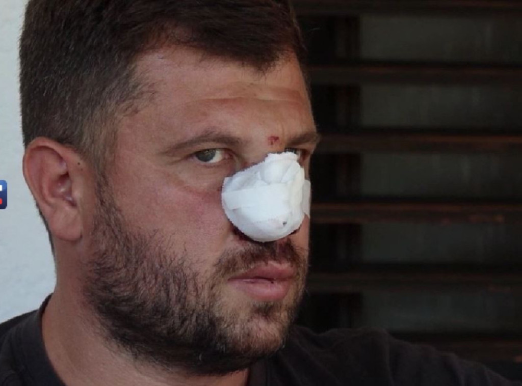 Napadnuti Srbin iz Donje Brnjice: Albanac me je napao bez razloga - i pre 10 dana je bio bahat