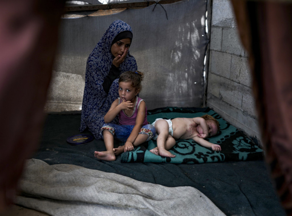 Više od 80 pacijenata, uključujući 35 dece, evakuisano iz Gaze radi lečenja u UAE